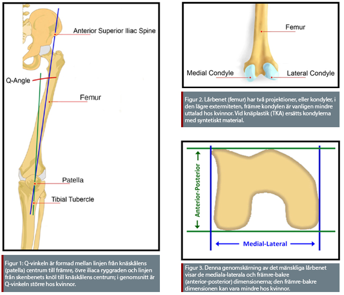 knee differences in women and men